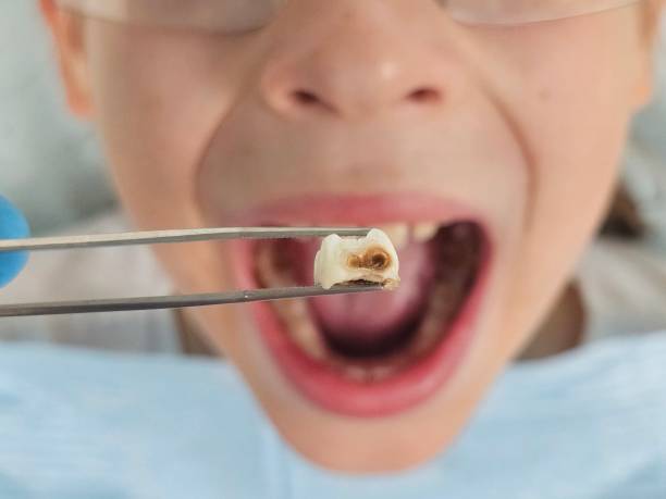 Best Walk-In Emergency Dentist in Rose, LA